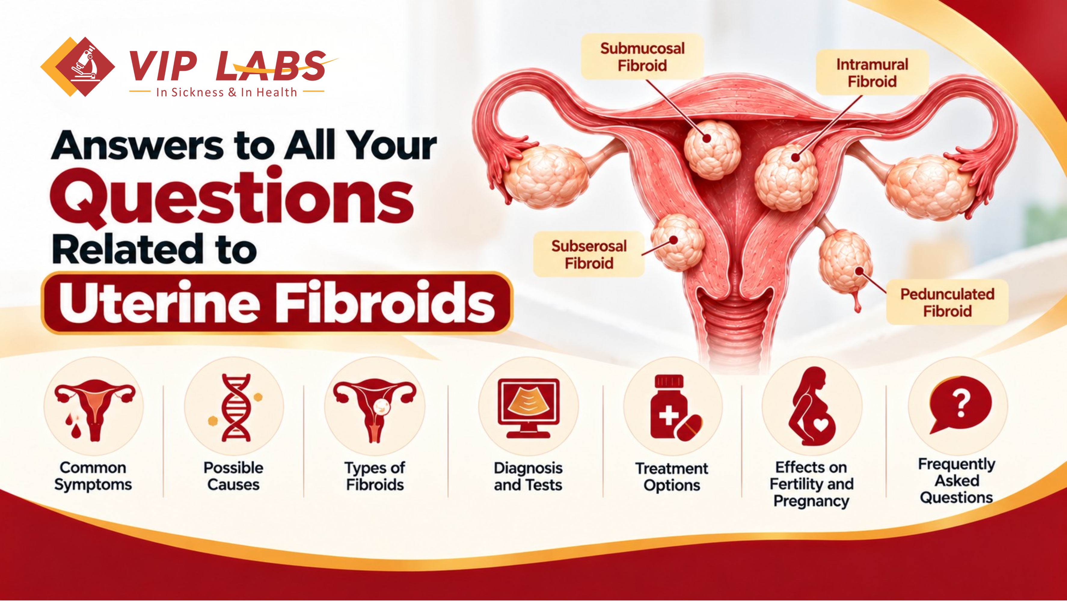 Answers to All Your Questions Related to Uterine Fibroids